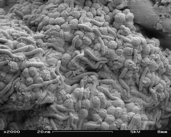 الطحالب والبكتيريا تحت الفحص الدقيق للمايكرسكوب الألكترونية حقوق الصورة: wikipedia, CC BY-SA
