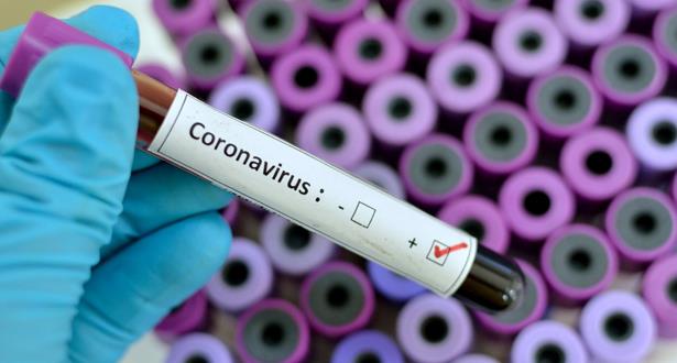 فيروس كورونا يثير الرعب في إيطاليا .. 29 وفاة و ألف إصابة مؤكدة
