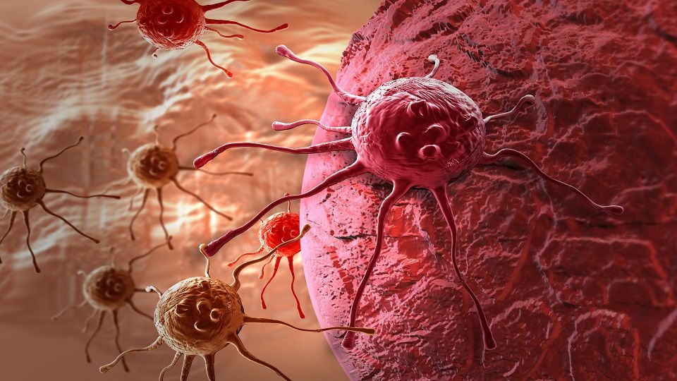 دراسة جديدة تلقي الضوء على ”النقائل السرطانية“