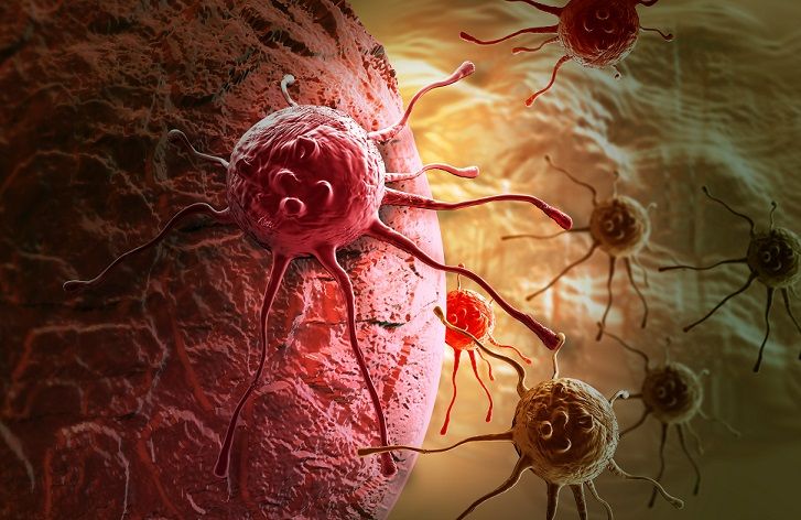 خلايا سرطانية في جسم الإنسان